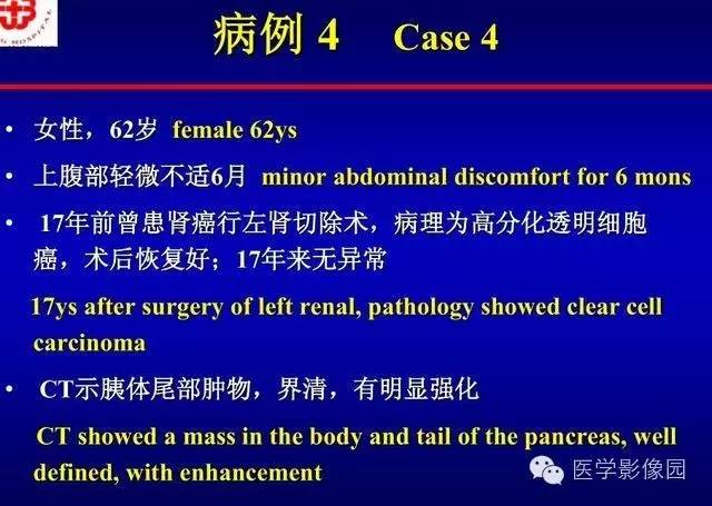 【PPT】胰腺少、罕见病变