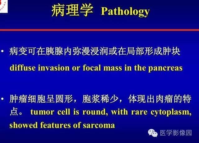 【PPT】胰腺少、罕见病变