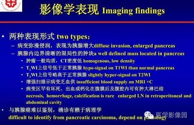 【PPT】胰腺少、罕见病变