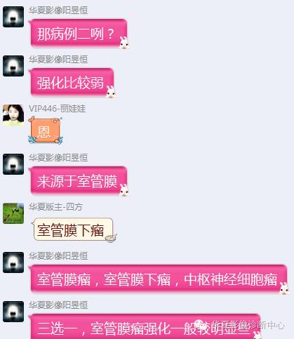 【病例】左侧脑室室管膜下瘤1例MR