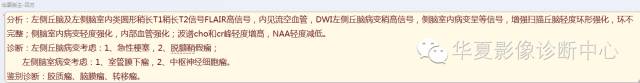 【病例】左侧脑室室管膜下瘤1例MR