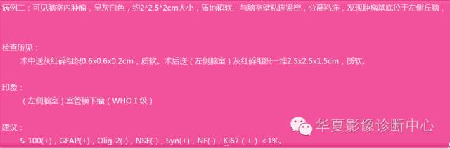 【病例】左侧脑室室管膜下瘤1例MR