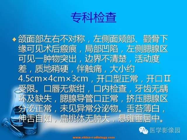 【病例】左面部朗格汉斯细胞组织细胞增生症1例CT