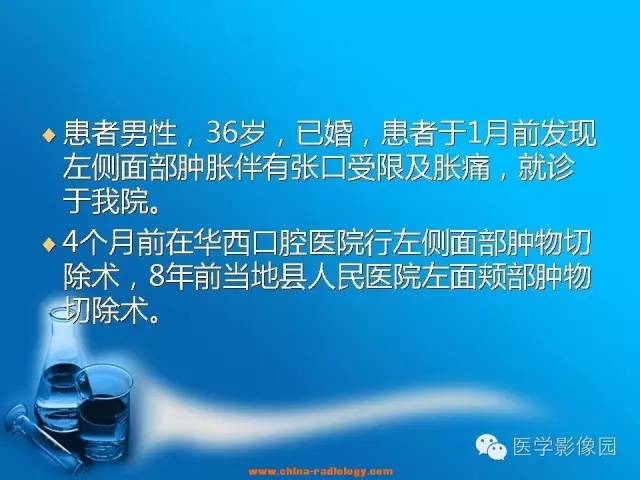 【病例】左面部朗格汉斯细胞组织细胞增生症1例CT