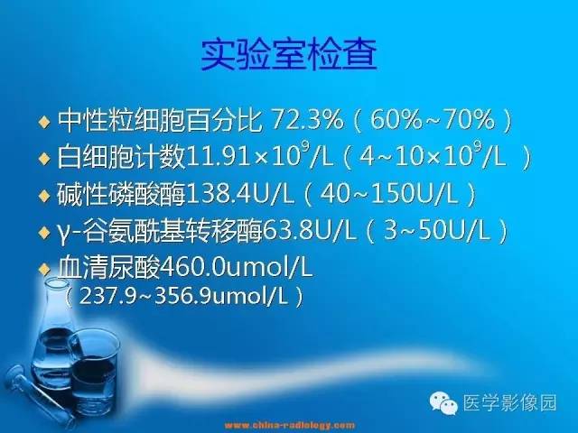 【病例】左面部朗格汉斯细胞组织细胞增生症1例CT