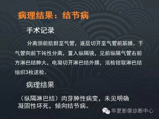 【病例】肺结节病1例CT影像表现