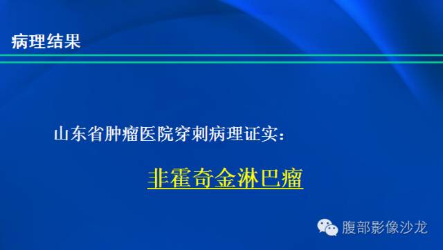 【病例】肝脏淋巴瘤1例MR影像表现
