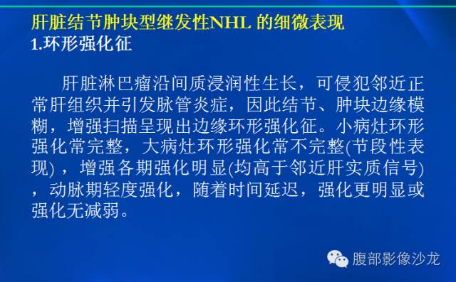 【病例】肝脏淋巴瘤1例MR影像表现