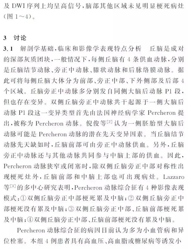 CT、MRI 诊断Percheron 动脉综合征