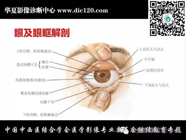 【PPT】眼及眼眶常见病变的影像诊断