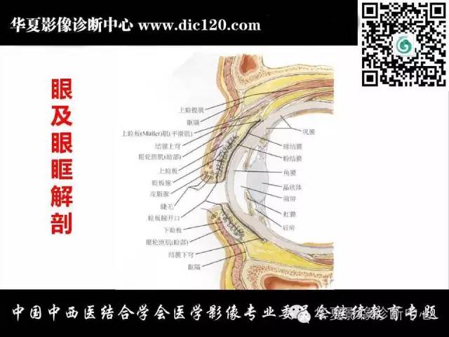 【PPT】眼及眼眶常见病变的影像诊断