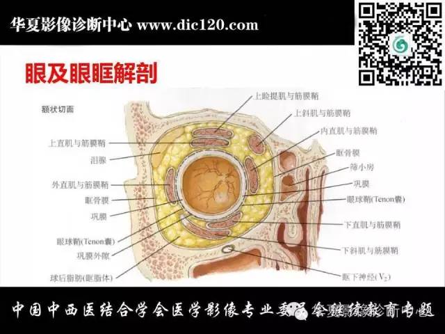 【PPT】眼及眼眶常见病变的影像诊断