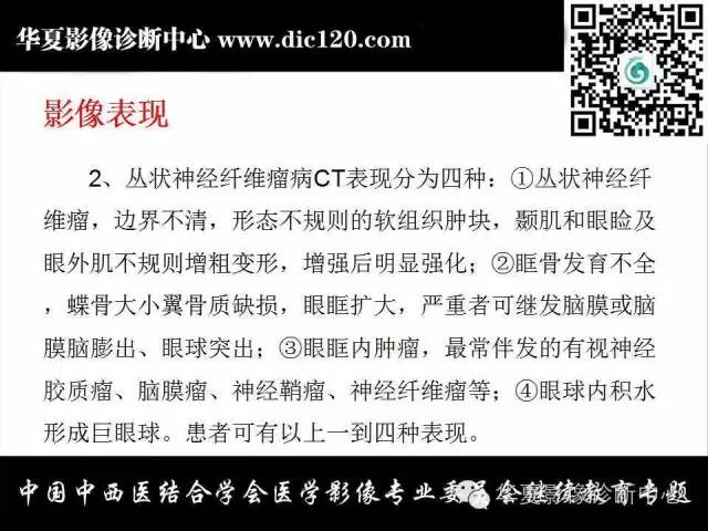 【PPT】眼及眼眶常见病变的影像诊断