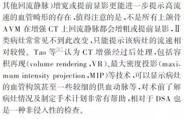 上颌骨动静脉畸形的影像学特点 上颌骨动静脉畸形的影像学特点