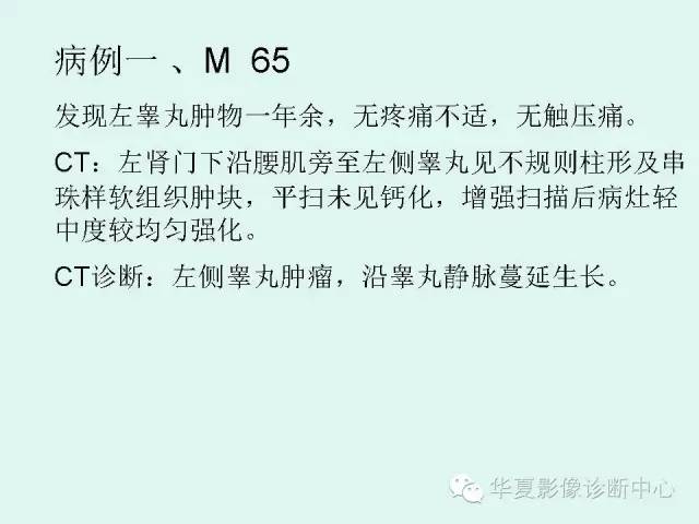 【病例】睾丸肿瘤2例CT