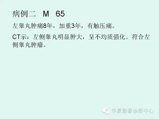 【病例】睾丸肿瘤2例CT