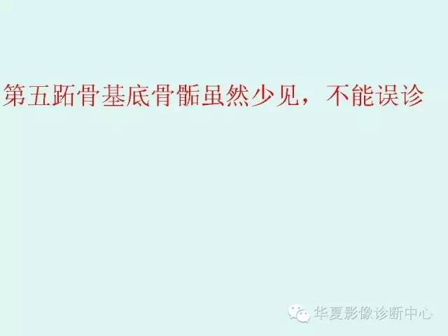 【PPT】骨骺？骨折？要分清