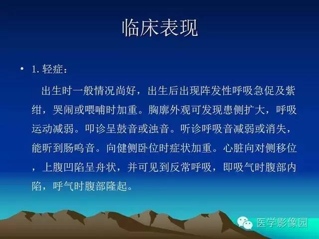 【PPT】膈疝的影像学诊断