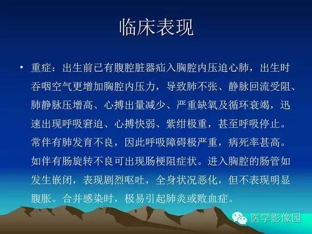 【PPT】膈疝的影像学诊断