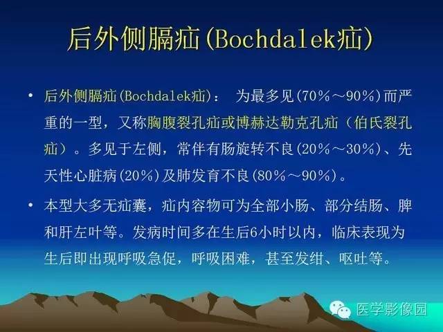 【PPT】膈疝的影像学诊断
