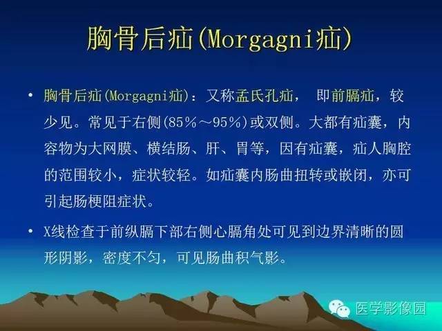 【PPT】膈疝的影像学诊断