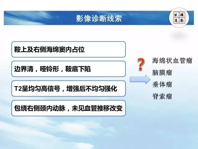 【病例】鞍区海绵状血管瘤1例MR影像表现与鉴别