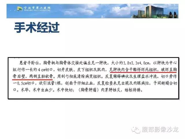 【病例】胸骨结核1例CT影像表现 【病例】胸骨结核1例CT影像表现