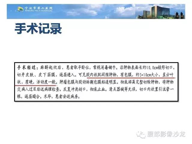 【病例】左大腿孤立性纤维瘤1例MR影像表现