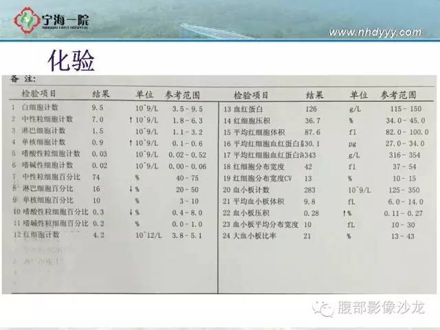 【病例】左肾滑膜肉瘤1例CT影像表现