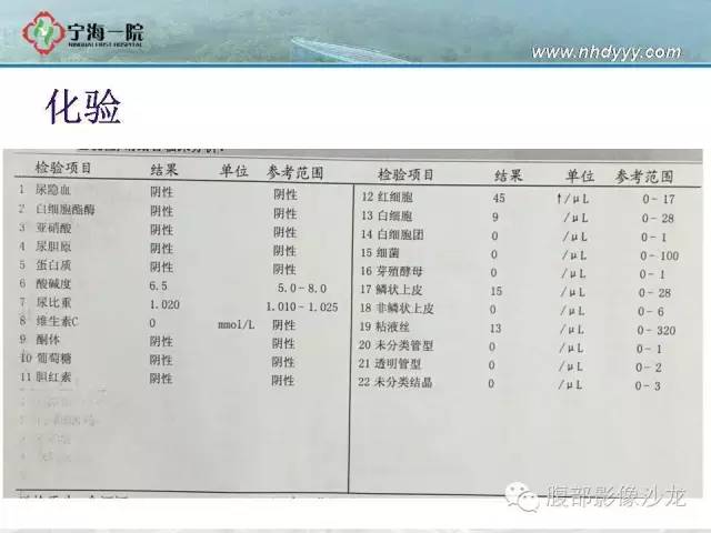 【病例】左肾滑膜肉瘤1例CT影像表现