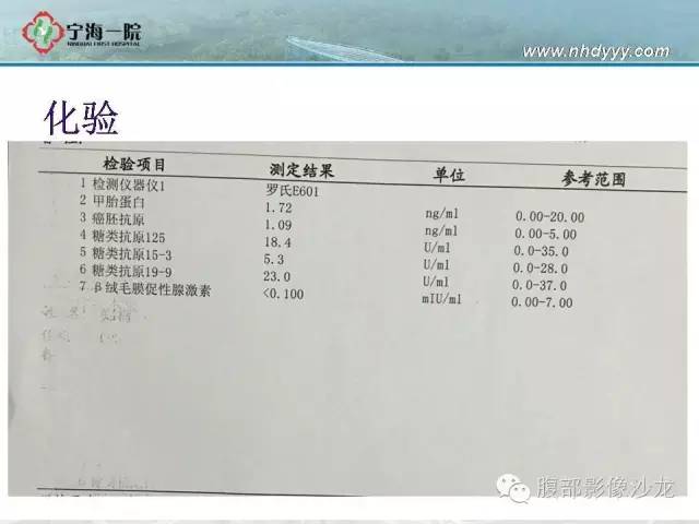 【病例】左肾滑膜肉瘤1例CT影像表现