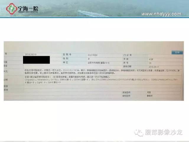 【病例】左肾滑膜肉瘤1例CT影像表现