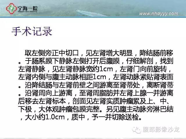 【病例】左肾滑膜肉瘤1例CT影像表现