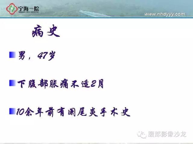 【病例】精原细胞瘤1例CT影像表现