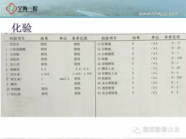 【病例】精原细胞瘤1例CT影像表现