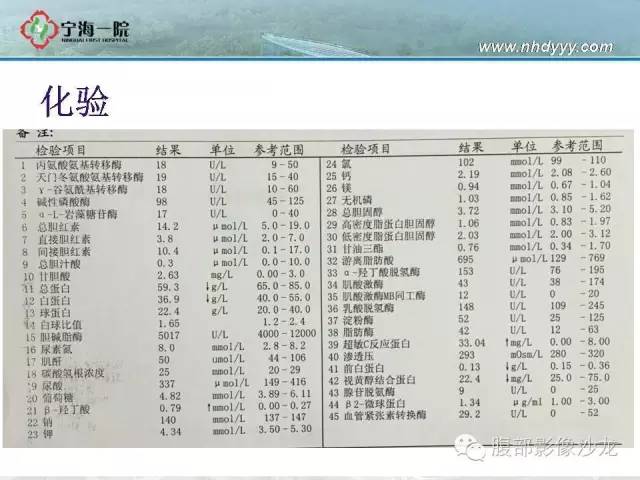 【病例】精原细胞瘤1例CT影像表现