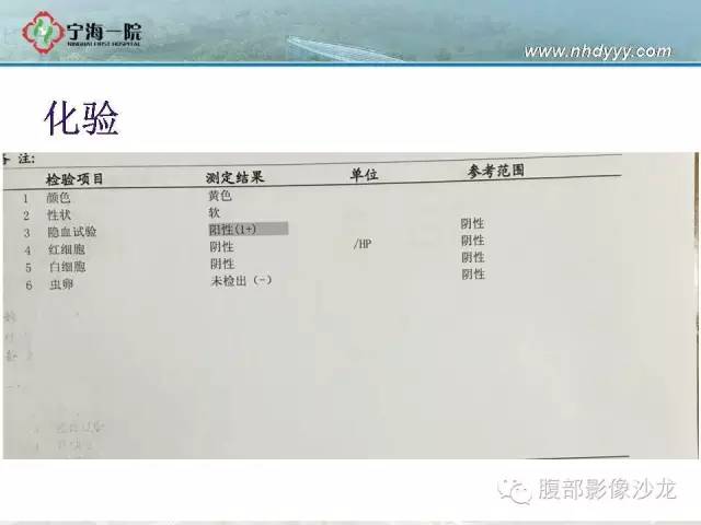 【病例】精原细胞瘤1例CT影像表现