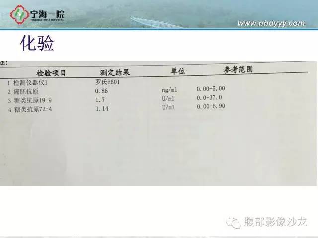 【病例】精原细胞瘤1例CT影像表现