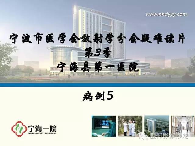 【病例】精原细胞瘤1例CT影像表现