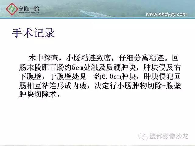 【病例】精原细胞瘤1例CT影像表现