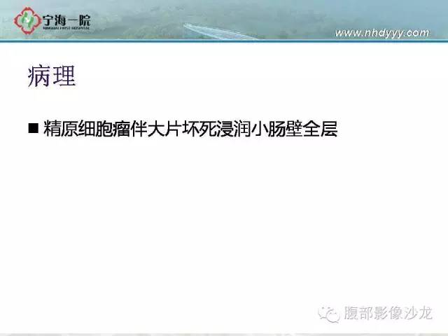 【病例】精原细胞瘤1例CT影像表现