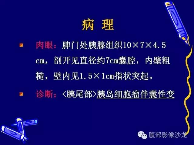 【病例】胰腺神经内分泌肿瘤1例CT及MR影像表现 【病例】胰腺神经内分泌肿瘤1例CT及MR影像表现