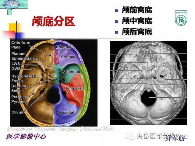 【PPT】颅底骨质破坏性病变的影像学诊断思路