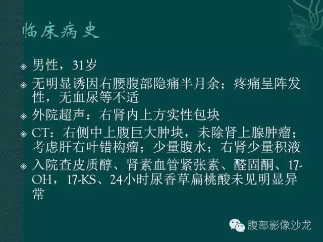 【病例】腹膜后精原细胞瘤1例CT影像表现