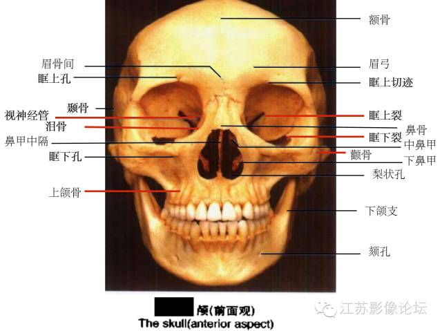 眼眶内常见肿瘤性病变的影像诊断