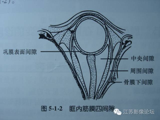眼眶内常见肿瘤性病变的影像诊断
