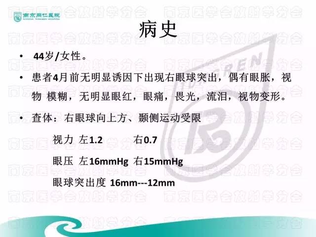 【病例】眼眶腺样囊性癌1例CT及MR影像表现