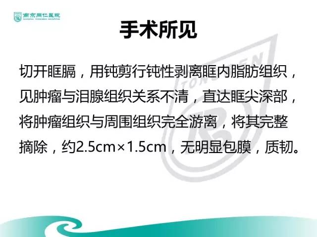 【病例】眼眶腺样囊性癌1例CT及MR影像表现