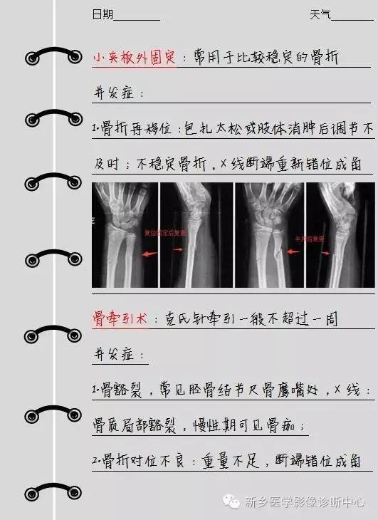 排除这些，就可以大胆的报内外固定术后改变了
