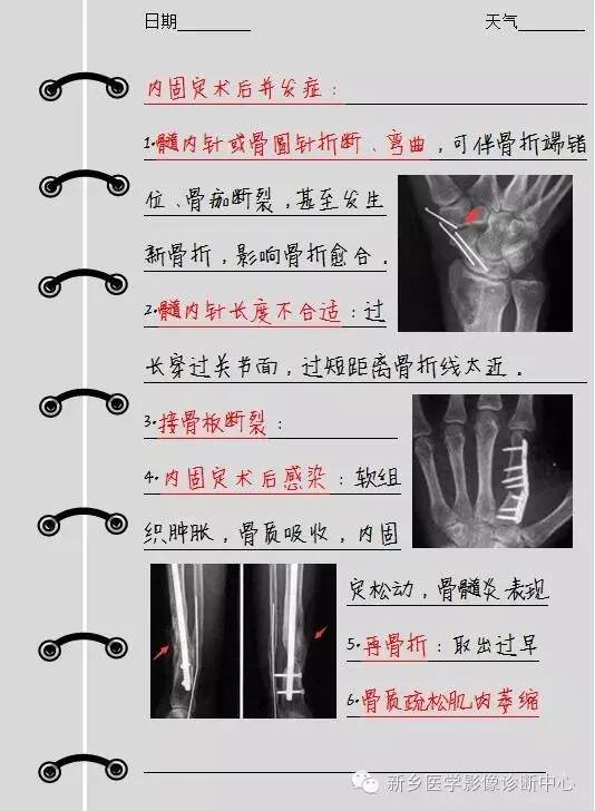 排除这些，就可以大胆的报内外固定术后改变了